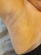 Nos soins esthétiques  Centre épilation au laser définitive pour maillot