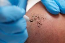 Nos soins esthétiques  Électrolyse visage, spécialiste de l'épilation définitive poil par poil