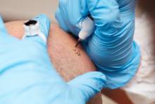 Nos soins esthétiques  Électrolyse visage : épilation définitive par électrostimulation (sans laser)