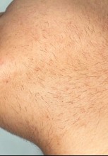 Nos soins esthétiques  Centre épilation au laser définitive pour maillot